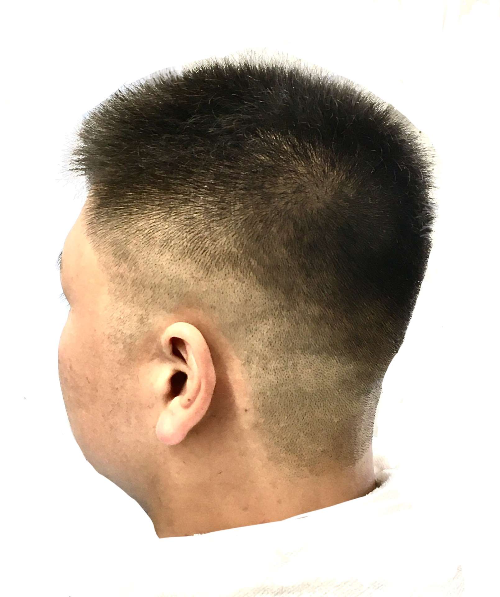 スキンフェード